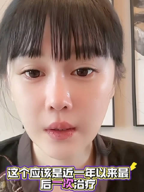 赵本山女儿球球称抑郁症好转将结束治疗